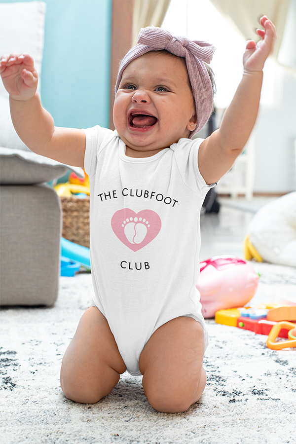 Clubfoot_baby_tee